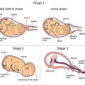Celeb Baby Laundry - Stages of Labor
