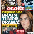 Kate Middleton Pregnant and Brain Tumor Rumors - Are They True?