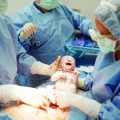 csection