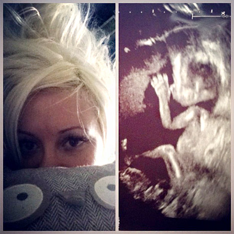 Holly Madison Expecting a Girl - Ultrasound