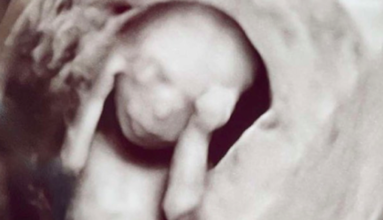 Unexpected-Lexus-baby