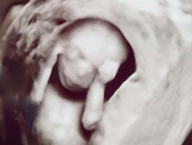 Unexpected: Lexus Scheller's baby girl