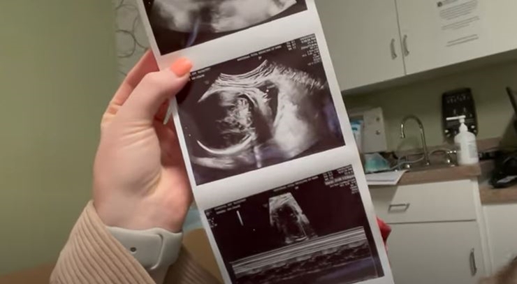 Counting On Alum Joy-Anna Forsyth Updates At 33 Weeks Pregnant
