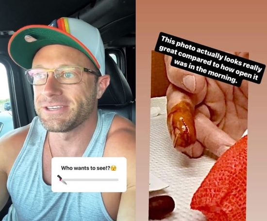 OutDaughtered Dad Adam Busby Has A Painful Accident