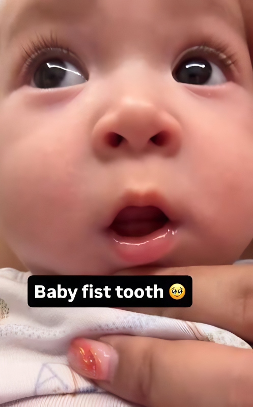 Minthira cuts her first tooth - Instagram