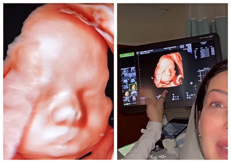 Clear pics of Becca's second baby - Instagram